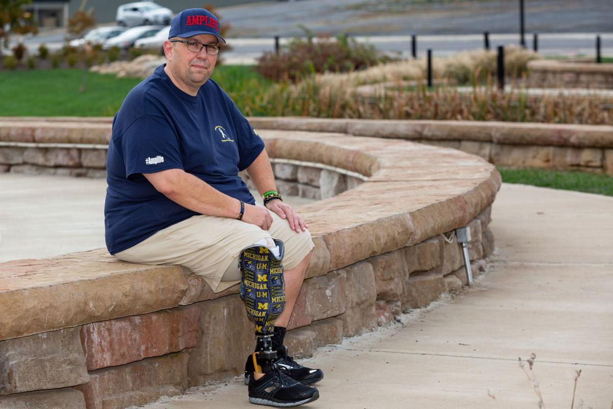 Johnson City Press: After Losing Leg, Area Man Looking To Provide Support, Resources For Other Amputees